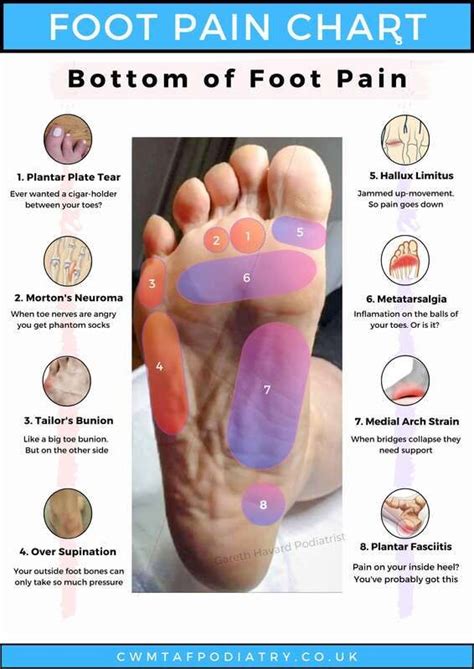 Foot Pain Chart Bottom Foot Pain Diagram