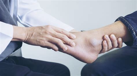 Foot and Ankle Treatment St. Luke