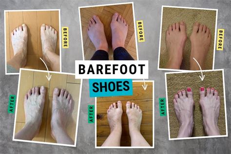 Foot transformation.  Explore the remarkable changes that occur with barefoot shoes befo...