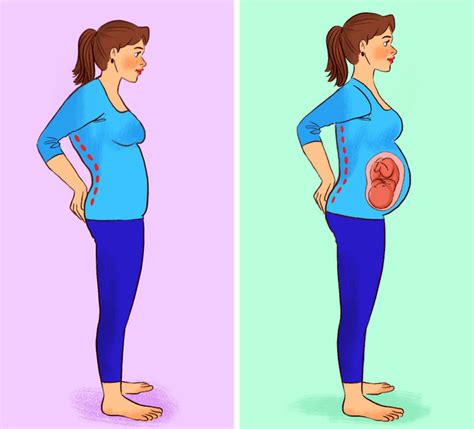 Foot transformation.  Many women experience these transformations during pregnancy, bu...