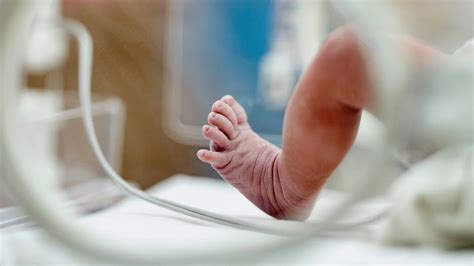 For second year in a row, US gets D+ grade for high preterm birth rate: ‘There’s so much work to be done’
