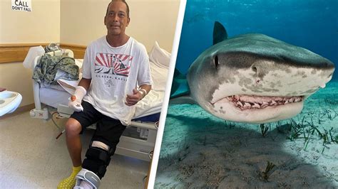 Fort Pierce surfer recalls shark attack while in recovery