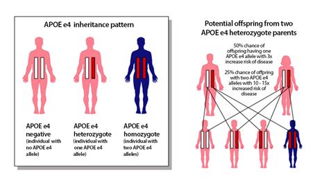 Four new genes for Alzheimer