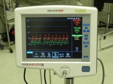 Fractional Flow Reserve (FFR) Measurement Technique - Medscape