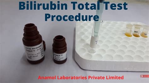 Fractionated bilirubin labcorp. None 25-Hydroxy Vitamin D (D2+D3 Fractionated), LC/MS-MS test cost minimal is in LabReqs (Vitamin D, 25-Hydroxy, LC/MS/MS) with price $55.99. 25-Hydroxy Vitamin D (D2+D3 Fractionated), LC/MS-MS test cost max is in True Health Labs (Fix Your Fatigue Blood Panel) with price $489.00. This laboratory test is available in 4 online lab test stores ... 