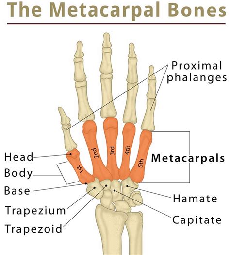 Closed fracture of base of right first metacarpal; Right first metacarpal base (hand bone) fracture; ICD-10-CM S62.231A is grouped within Diagnostic Related Group(s) (MS-DRG v 41.0): 562 Fracture, sprain, strain and dislocation except femur, hip, pelvis and thigh with mcc . Fracture of right hand icd 10