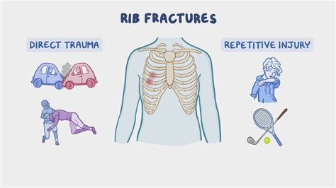 Fracture risk in patients with different types of cancer