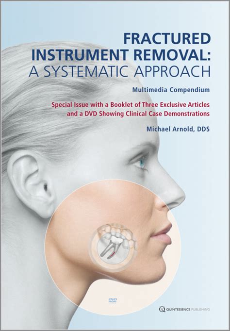 Read Online Fractured Instrument Removal A Systematic Approach By Michael Arnold