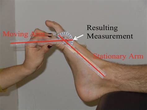 Free Physical Therapy Flashcards about UE LE goniometry - StudyStack