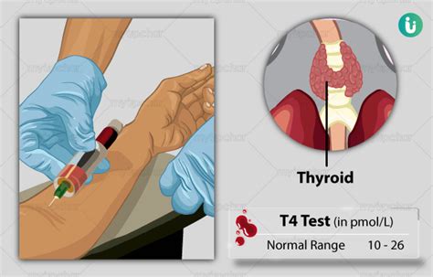 Free T4 Thyroxine Dialysis Test in Charlotte, North Carolina