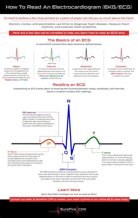 Free ekg interpretation cheat sheet.  Check out our ekg reading guide selection for the very...