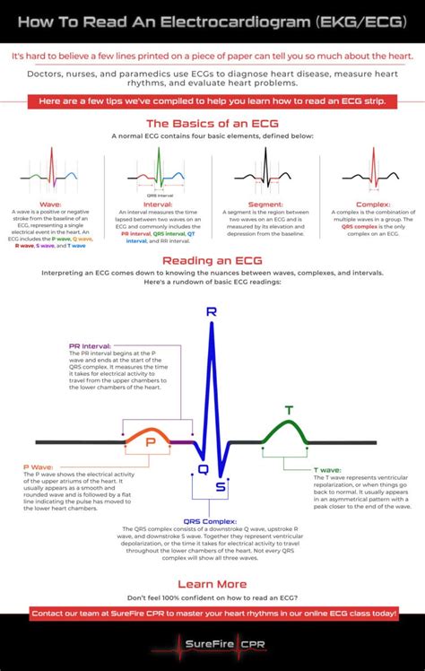 Free ekg interpretation cheat sheet.  Feb 28, 2011 · A simple, step-by-step guide...