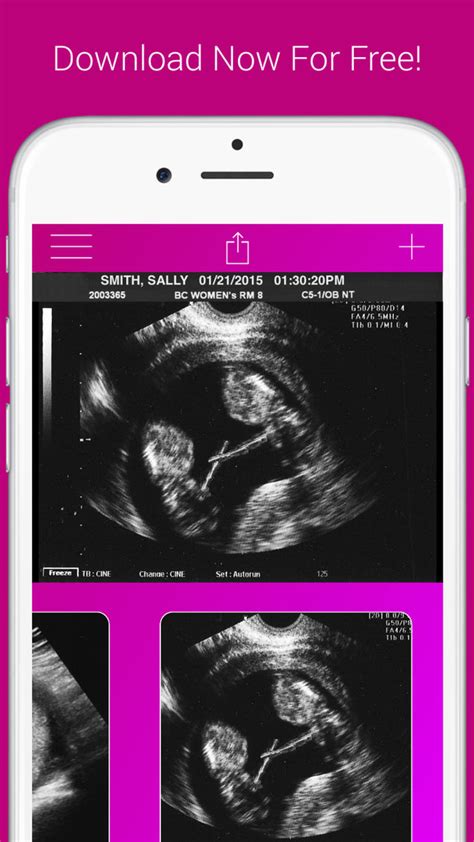 Free fake ultrasound app iphone. Oct 7, 2023 · mehdihp125 / fake-twin-ultrasound. Create fake pregnancy ultrasound easily. GitHub is where people build software. More than 100 million people use GitHub to discover, fork, and contribute to over 330 million projects. 