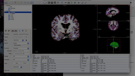 FreeSurfer: FreeView Demo - YouTube