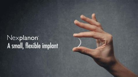 Frequently Asked Questions About Nexplanon