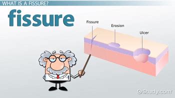 Frisure Definition & Meaning - Merriam-Webster