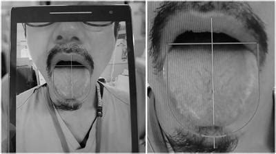 Frontiers Construction of a Standardized Tongue Image Database for