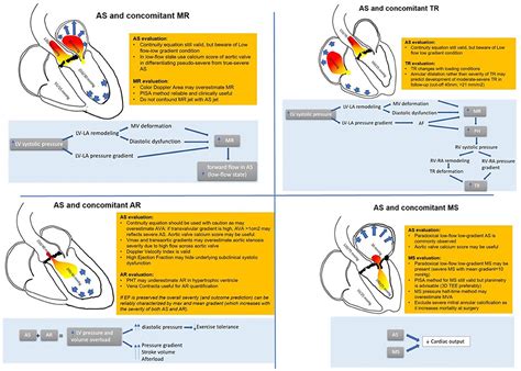 Frontiers When Aortic Stenosis Is Not Alone: Epidemiology ...