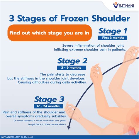 Frozen Shoulder: What To Do And What Not To