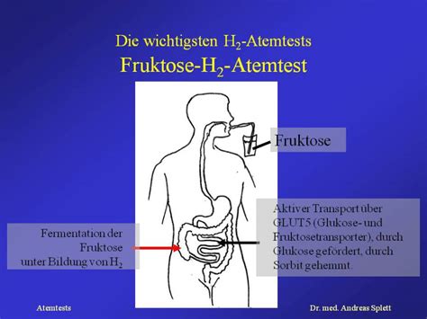 Fruktose-H2-Atemtest SpringerLink