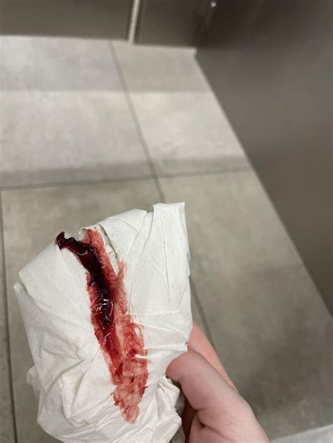Ftm breakthrough bleeding reddit.  TW:Blood/Period discussion.  For example, I had my la...