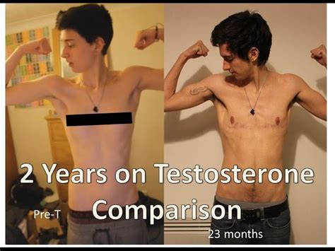Ftm testosterone discharge reddit.  Some people affirm that FTM individuals are pred...