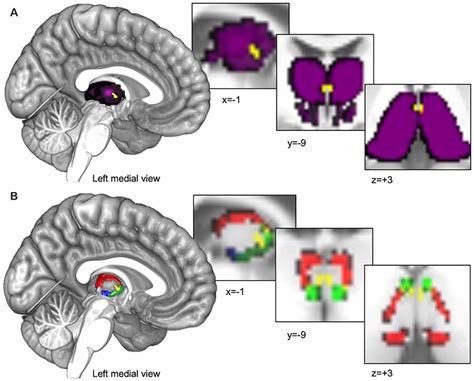 Functional connectivity between the thalamus and the …