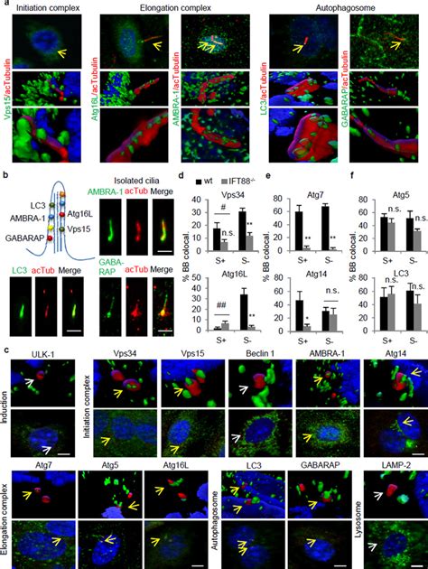 Functional interaction between autophagy and ciliogenesis