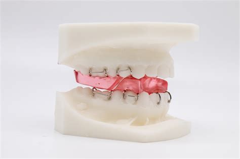 Functional orthodontic appliances.  Functional Appliances Functional appliances like th...