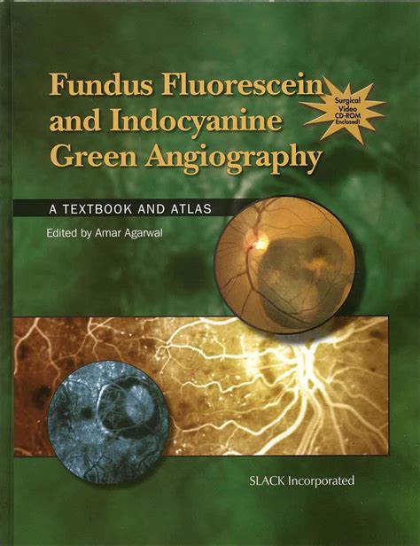 Fundus fluorescein and indocyanine green angiography a textbook and atlas. - New home sewing machine parts manual.