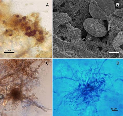 Fungal biofilms from dishwasher rubber and drawer …