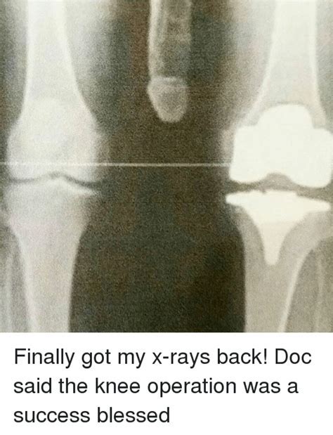 4. X-Ray Selfie! Someone's got to say it…. "Let us take a Skelfie!". Here's a tip: radiologists should start using Skelfies as their profile pictures…. 5. A Radiologist's Luck in a Nutshell. Good thing the first one was for comparison anyway…. Credit: Posted on Reddit by @Mickturd.. 