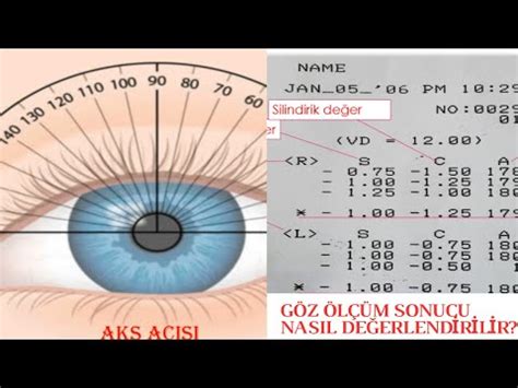 Göz ölçümü nasıl okunur