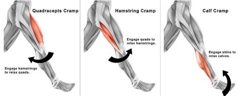 Gambar Kram Otot - balustradellc