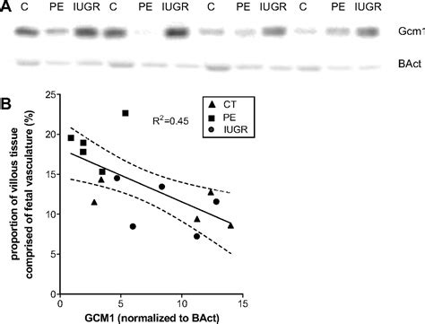 GCM1 protein expression summary - The Human Protein Atlas