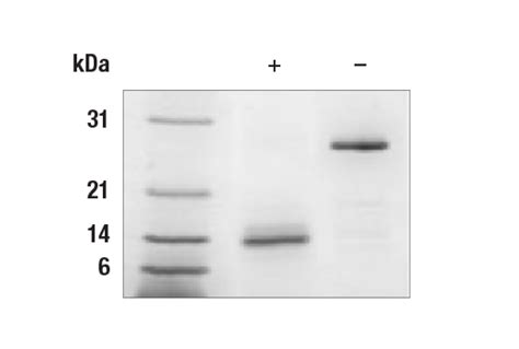 GDF15 Protein Human Recombinant NAG-1 Antigen ProSpec