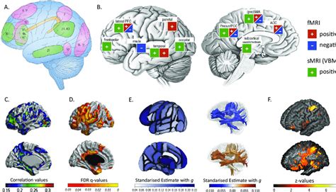 Genetic variation, brain, and intelligence differences | Molecular ... - muktibox.com