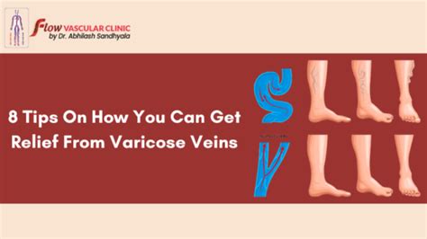 Get Relief from Sciatica and Varicose veins by ... - balustradellc