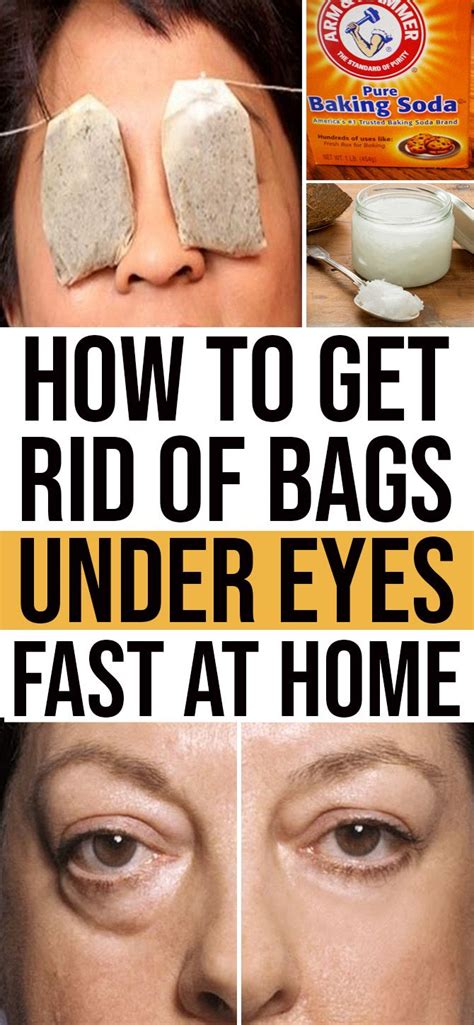 Get rid of bags under eyes | UnitedHealthcare - balustradellc
