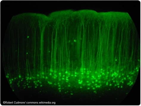 Gfp Fluorescence Microscopy Cells - wintechmobiles.com