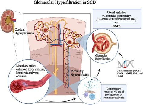 Glomerular Hyperfiltration and Cardiovascular Risk in … - balustradellc
