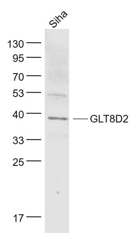 GLT8D2 Polyclonal Antibody (PA5-112428) - thermofisher.com