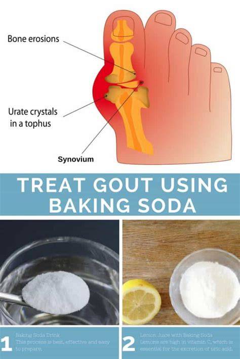 Gout and Baking Soda - Experiments on Battling Gout - raincitystudios.com