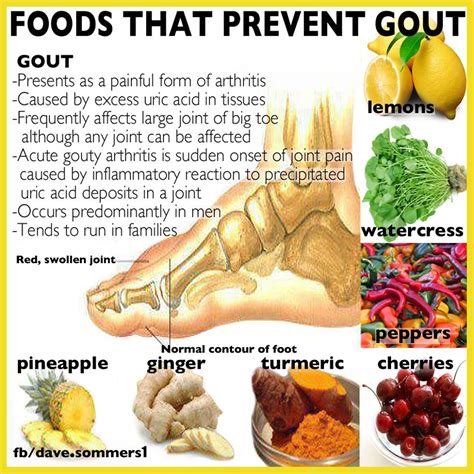 Gout diet: What's allowed, what's not - Mayo Clinic - balustradellc