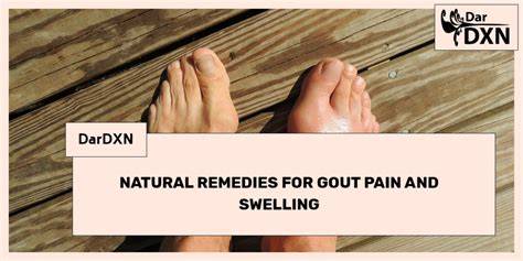 Gout Relief: Natural Remedies for Pain and Swelling - raincitystudios.com
