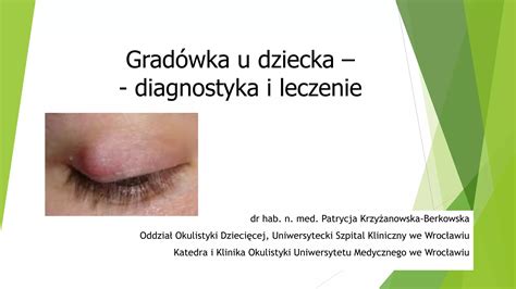 Gradówka u dziecka - Dziś pytanie - dziś odpowiedź - Forum - balustradellc