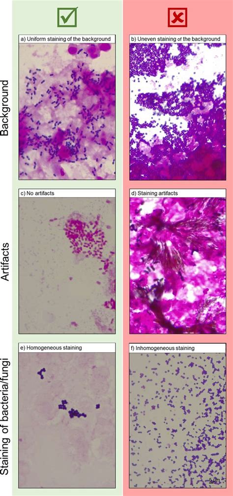 Gram Staining: a Comparison of Two Automated Systems and Manual ... - muktibox.com