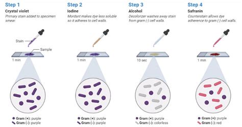 Gram Staining Tests - Examination, and Examination Procedures - AI … - muktibox.com