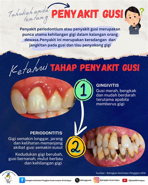 Gusi Tts - balustradellc