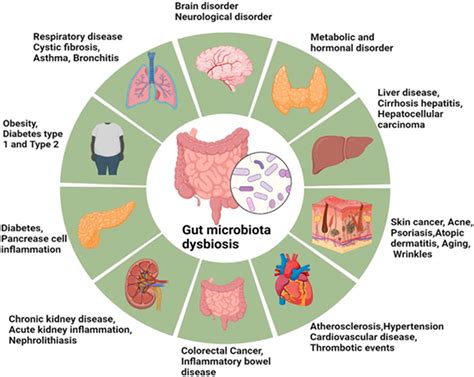 Gut Microbiota - Nature - muktibox.com